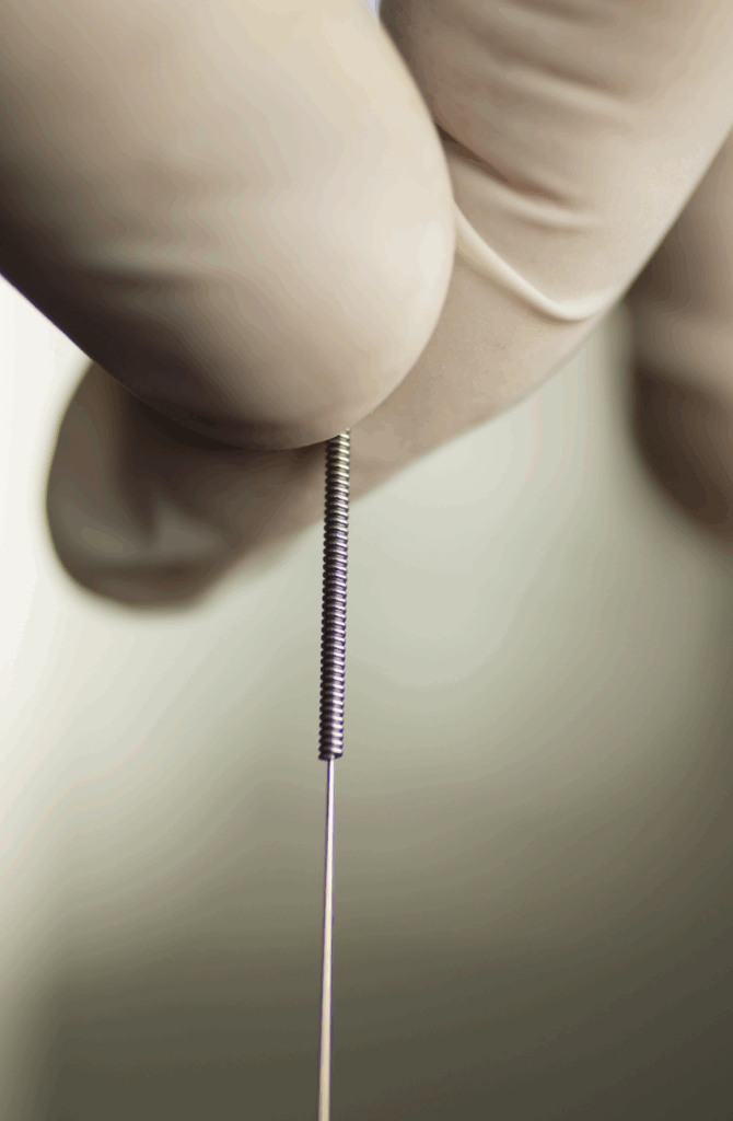 dry needling